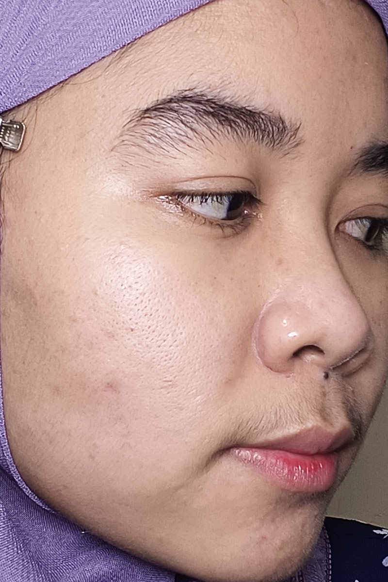 After
