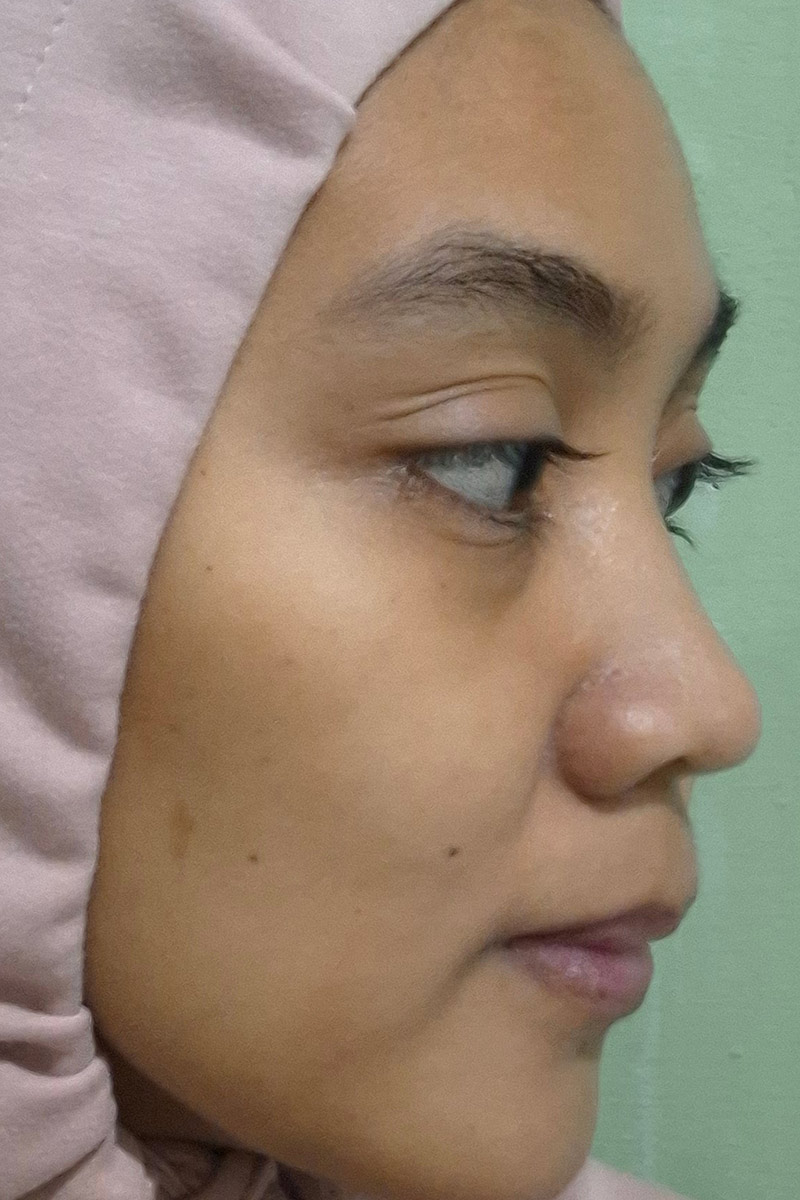 Before