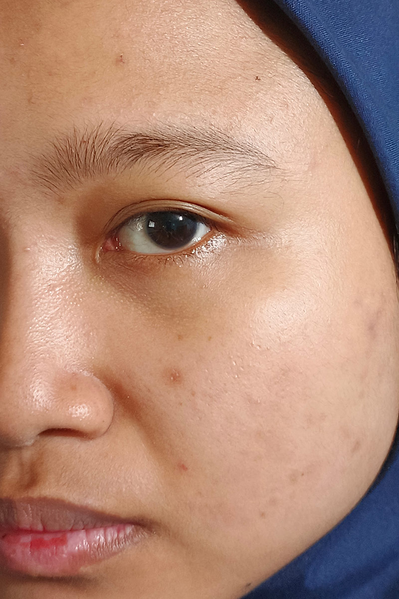 Before