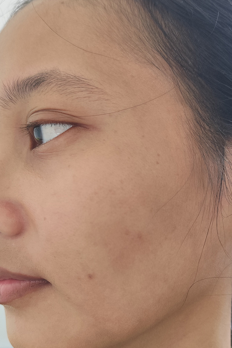Before