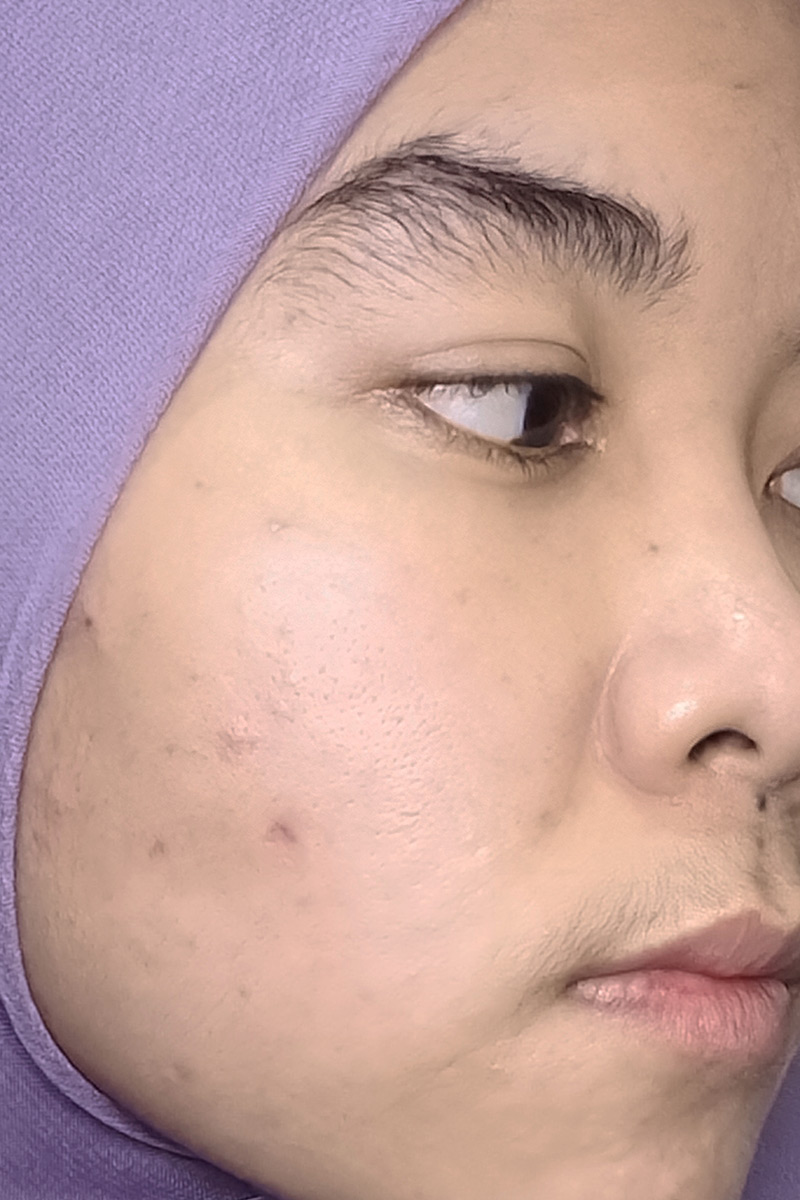 Before