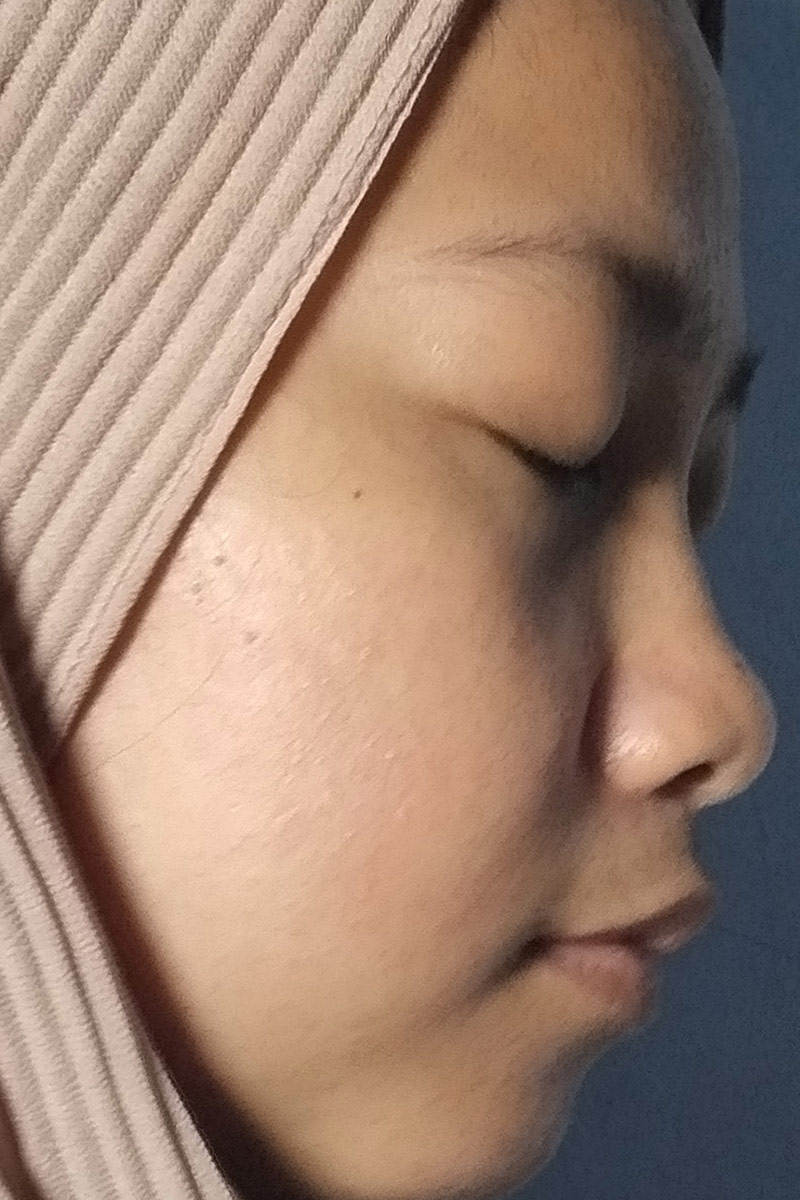 Before