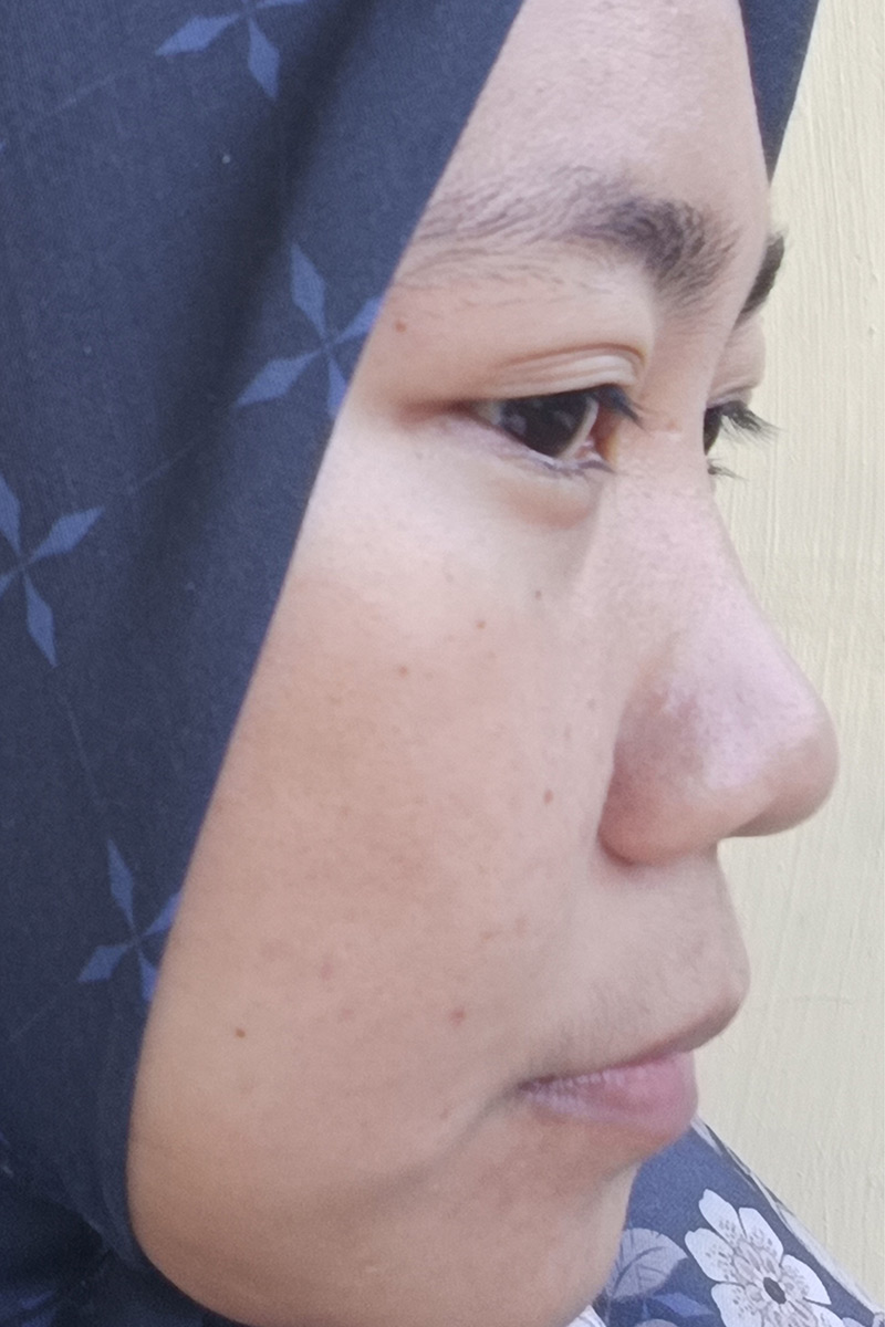 Before