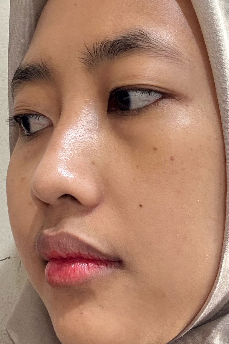 Before